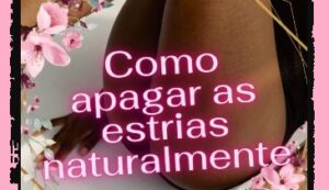 Como Apagar as Estrias Naturalmente
